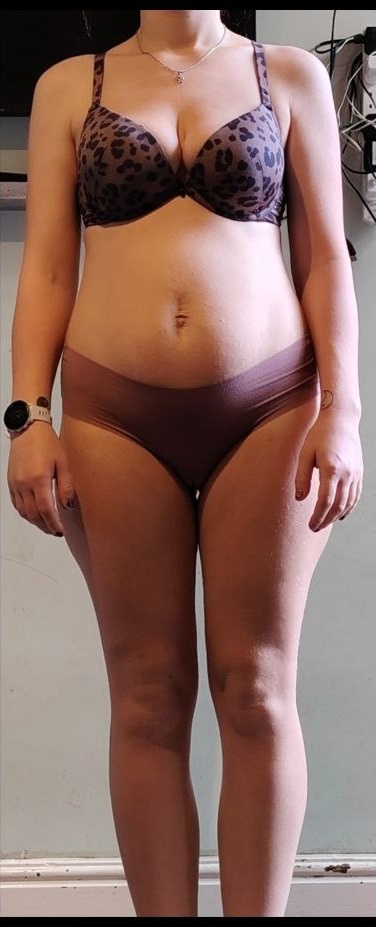 Evelina after losing 12 kg, front view